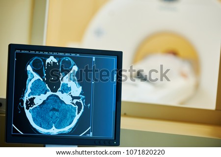 MRI scan test or computed tomography. Display with brain x-ray image