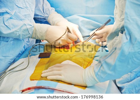 Heart transplantation. Human heart in surgeon hands during cardiac surgery operation