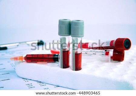 Hematology blood analysis report with blood sample collection tubes and syringe. (blue tone)