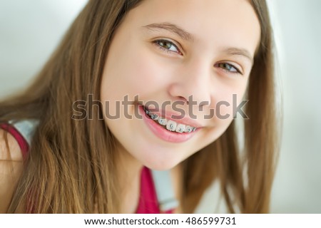 Portrait of cute kid with dental braces smiling.