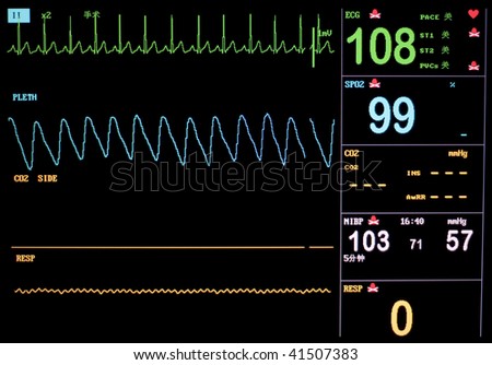 Boy\'s EKG on oxygen while under anesthesia