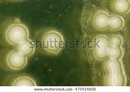 Yeast under the microscope