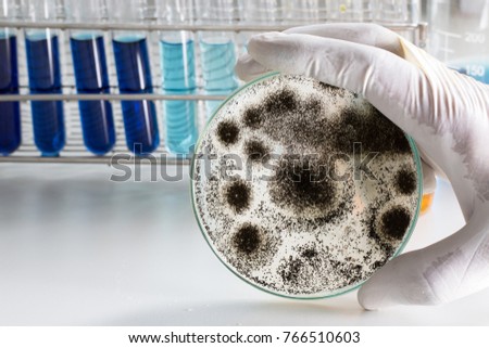 Aspergillus (mold) for Microbiology in Lab.