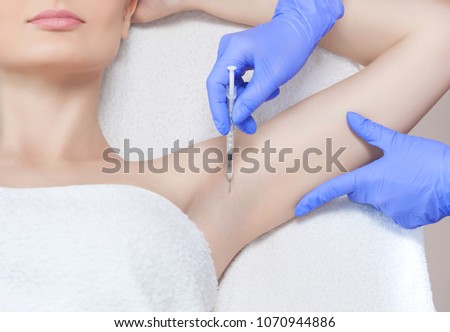 The doctor makes intramuscular injections of botulinum toxin in the underarm area against hyperhidrosis.