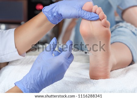 The doctor makes intramuscular injections of botulinum toxinon the feet of a woman against hyperhidrosis.