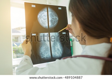 Selective focus Thoughtful female doctor looking at the Mammogram film image.