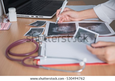 Doctor holding ultrasound pregnant on working table  in the hospital.
