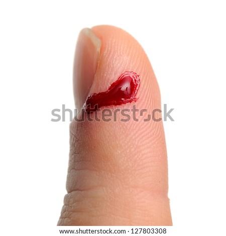 Bleeding from Cut Finger
