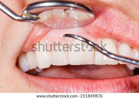 Periodic dental examination to have a healthy mouth and teeth.
