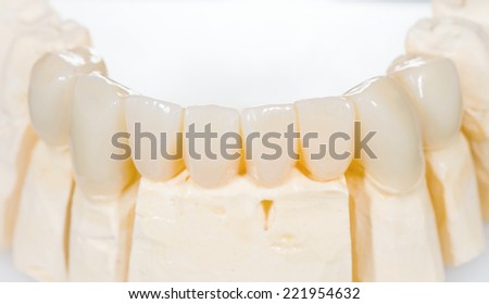 Dental ceramic bridge on isolated white background