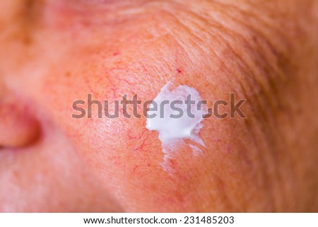 Close up photo of elderly woman face and patch cream on cheek