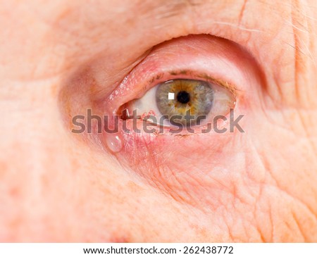 Close up photo of elderly woman eye