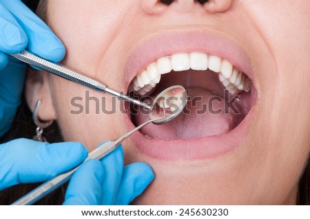 Closeup of dentist tools and mouth open with beautiful teeth