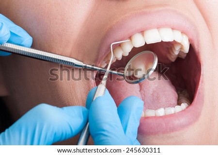 Dentist cleaning perfect teeth of a beautiful mouth female