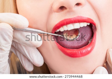 Perfect teeth mirroring. Beautiful denture concept