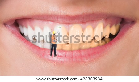 Close-up of perfect smile before and after bleaching as dental whitening concept