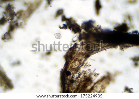 A Genuine Philodina Rotifer, a Microscopic animal that lives in fresh water. Most rotifers are around 0.1Ã¢Â?Â?0.5 mm long. Shot with a DSLR through a Microscope with a special adaptor. Microscopic life