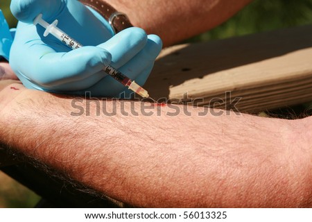 a person wearing a latex glove gives himself an injection with a hypodermic needle