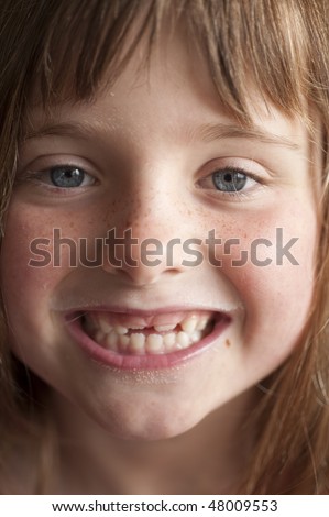 portrait of little girl (5 years old) smiling big with two missing front teeth