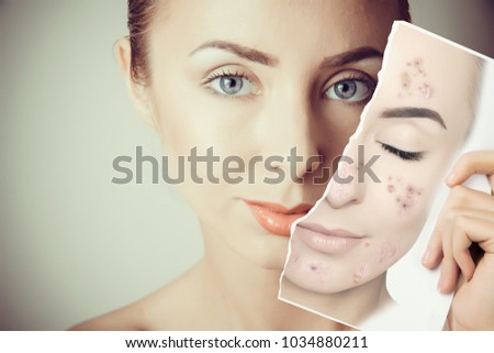 young woman face portrait with photo of her old skin