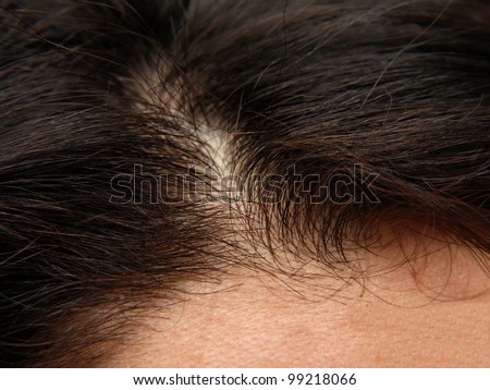 Close up of a humans head, brown thick hair