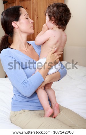Mother comforting crying baby with rash