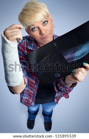  - stock-photo-young-woman-holding-x-ray-her-broken-arm-131895539