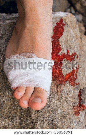 Medicine bandage on human injury foot after accident and blood on rock