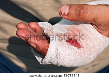 Medicine bandage with blood on human injury hand after accident with chainsaw