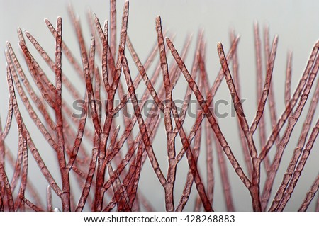 red algae, Rhodophyceae (Rhodophyta), marine alga, micro-photography, Mediterranean sea, Benthos,