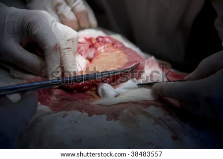 Abdominal Surgery. small intestine segment.