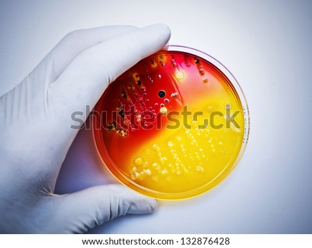 Hand in white rubber glove holding a petri dish