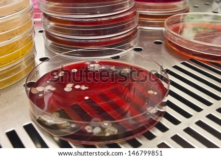 Petri dish with bacteria on a stainless steel surface