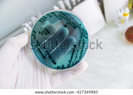 Hand holding a petri dish with bacteria colonies. Selective focus