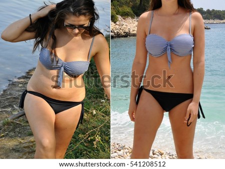 Real before and after weight loss photo of woman\'s body in bikini. Unprofessional, amateur natural before and after photos, which can be used as illustrative for advertising slimming products