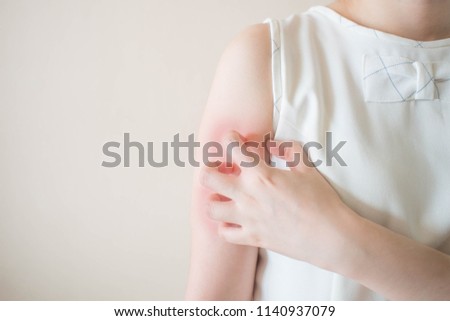 Young woman scratching arm from having itching on white background copy space. Cause of itchy skin include insect bites, dermatitis, food/drugs allergies or dry skin. Health care concept. Close up.