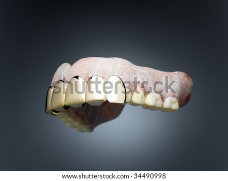 Dentures with gold teeth in font