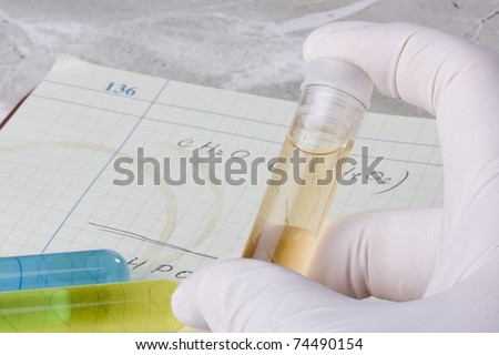 Hand holding a test tube in front of a laboratory notebook.