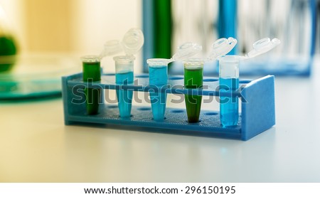 Micro tubes with biological samples in laboratory for DNA analysis .