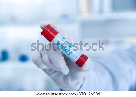 Blood sample positive with Zika virus.toned image.