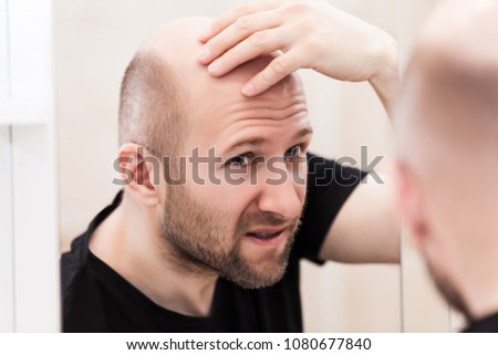 Male alopecia or hair loss concept - adult caucasian bald man looking mirror for head baldness treatment
