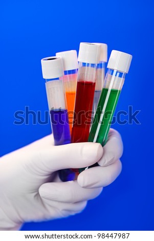 Medical test tubes with fluid sample closeup in gloved hand on blue background