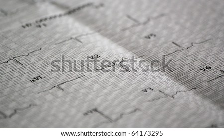 Design of a medical electrocardiogram on a paper
