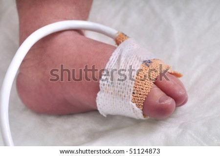 Close up of the foot of a premature baby boy - a series of BABY INTENSIVE CARE related pictures.