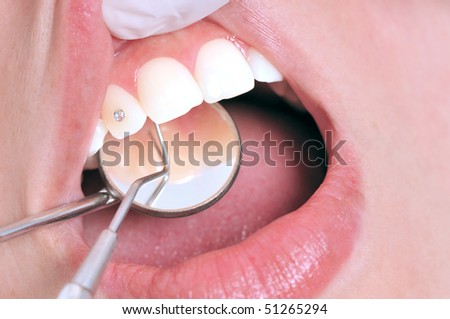Close-up of patient s open mouth before oral inspection with hook and mirror near by - DENTAL IMAGES