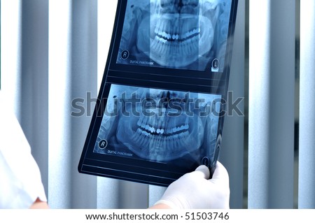 Dentist looking at x ray of patients teeth - a series of DENTAL related images.