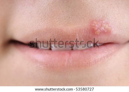 Pictures Of Lips. stock photo : Close up of lips