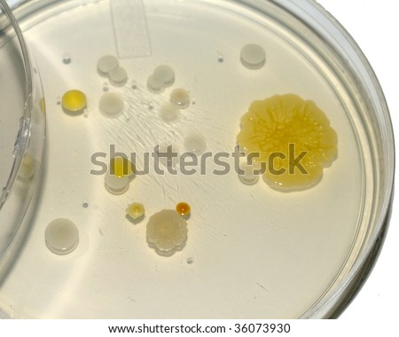 Different colored bacterial colonies growing on agar plate.