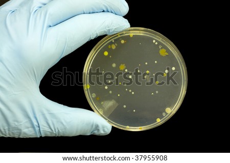A petri plate being assessed for bacteria, yeast and molds.
