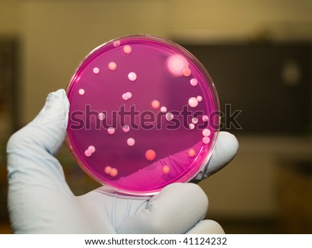 A petri plate being assessed for yeast and molds.